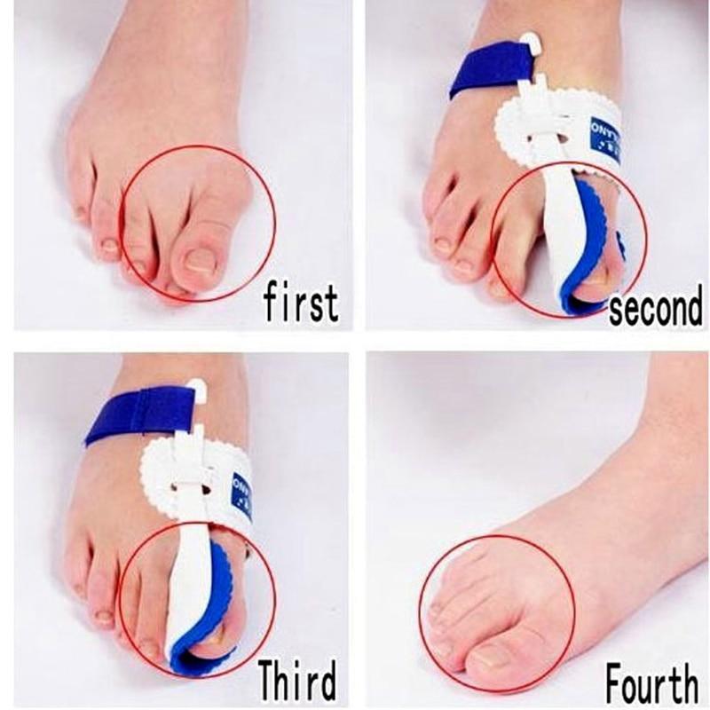 Toe Brace