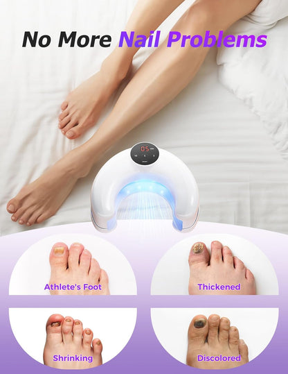 ISKIX™ BioClear - Restore Strong, Beautiful Nails by Tackling Fungus and Discoloration